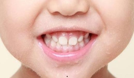 成人拔乳牙的视频播放,专业视频带你了解拔牙技巧与注意事项